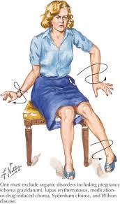 Movement Disorder Treatment Services